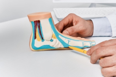 Flat Feet in Women