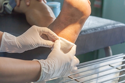 Foot Wounds and the Vital Role of a Podiatrist